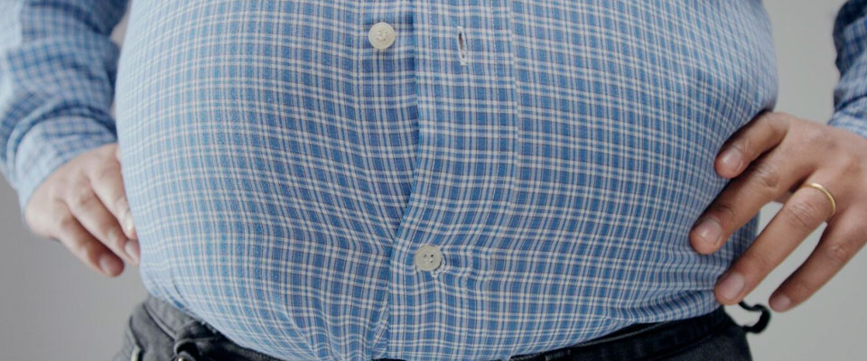 Lipodistrofia é o mesmo que gordura localizada?