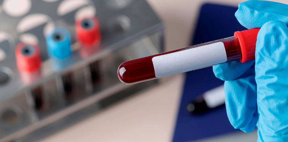 A importância do diagnóstico precoce do diabetes tipo 2