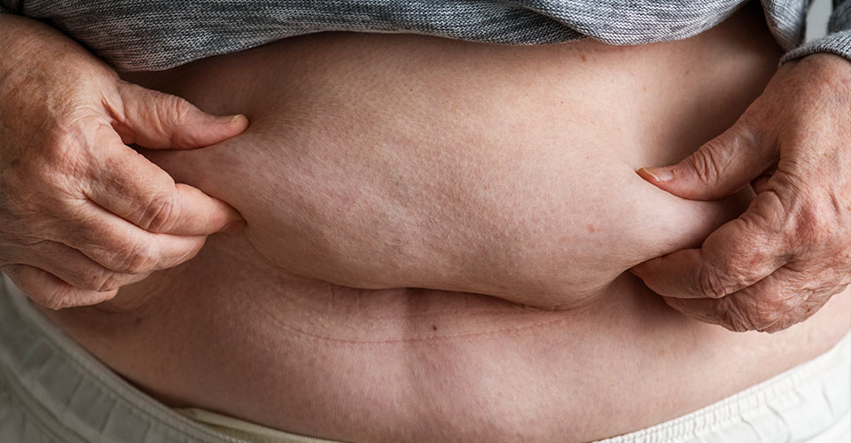 Principais componentes da síndrome metabólica