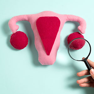 Cisto no ovário e desequilíbrio hormonal