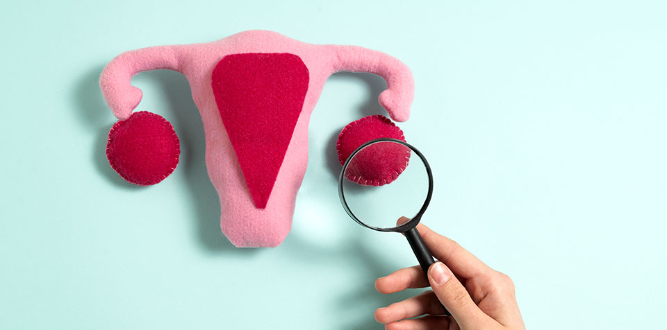 O que é um cisto no ovário?