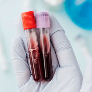 Check-up hormonal: quais exames são essenciais para avaliar sua saúde metabólica
