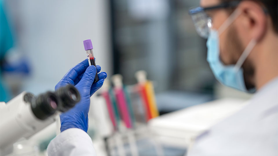 O que é um check-up hormonal e por que ele vai além do exame de rotina comum