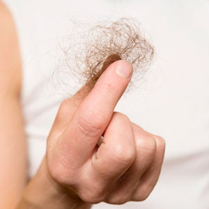 Queda de cabelo pode ser hormonal? Descubra quando procurar um endocrinologista